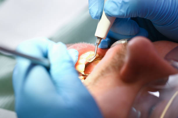 Best After-Hours Dental Trauma Care in Shpee Neck, MA