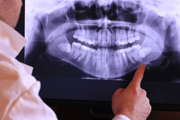 Best Emergency Tooth Extraction in Shpee Neck, MA